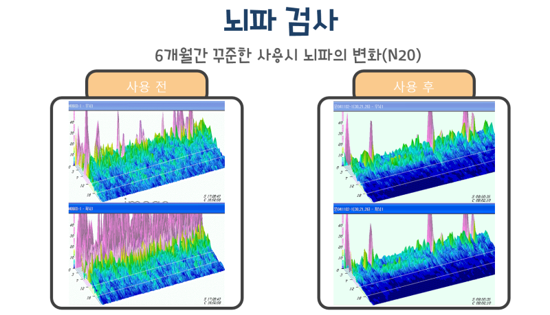 뇌파교육
