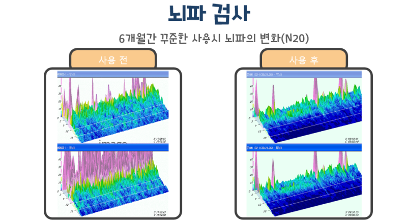 뇌파교육